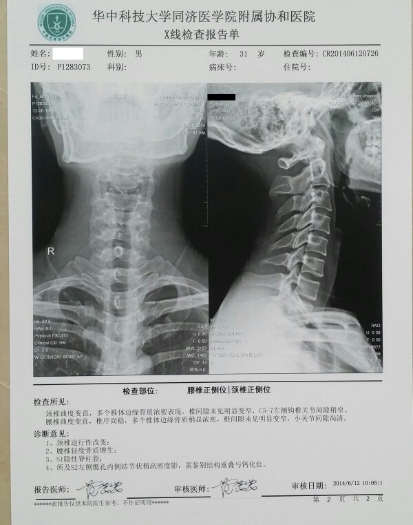 颈椎曲度变直恢复可能？康复科医生亲授科学训练方案